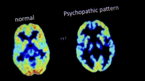 A positron emission tomography (PET) scan comparing a normal brain and a brain with a psychopathic pattern typical for serial killers. Such images are often analyzed and discussed in the Criminal & Forensic Psychology Circle.