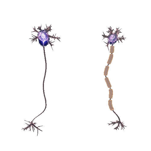 The image shows an action potential going through a neuron’s axon. In the left one, the signal stops midway because of a lack of myelin. In the right one, the signal successfully goes through because of the presence of myelin. 

